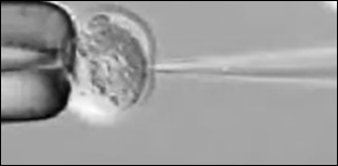 Dna Transgenes